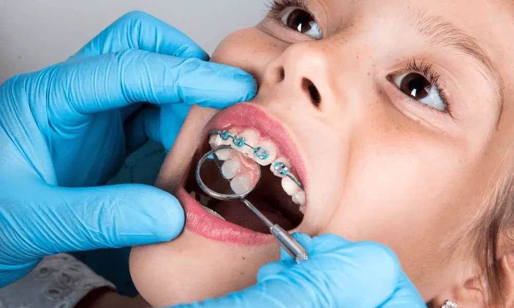 What Can a Pediatric Orthodontist Do for My Child